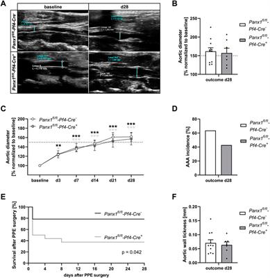 Platelet pannexin-1 channels modulate neutrophil activation and migration but not the progression of abdominal aortic aneurysm